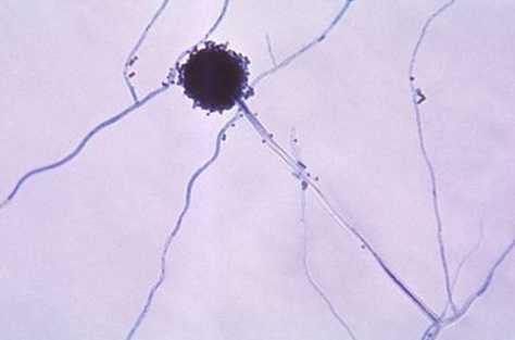 aspergillus mold